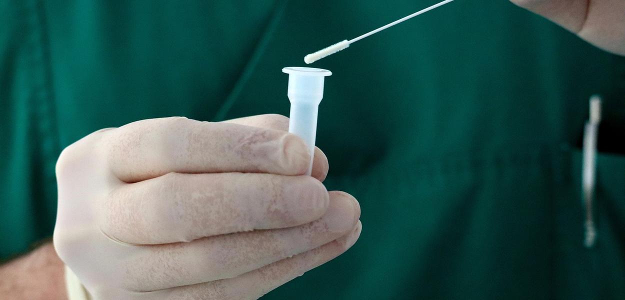 Fotografija uz vijest: Prvi slučaj infekcije virusom zika potvrđen u Sjevernoj Makedoniji